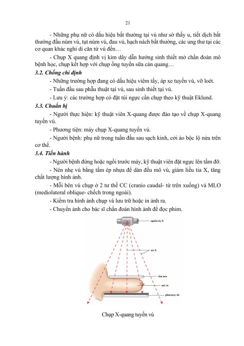 2HDSLUTV.signed-h&igrave;nh ảnh-20.jpg