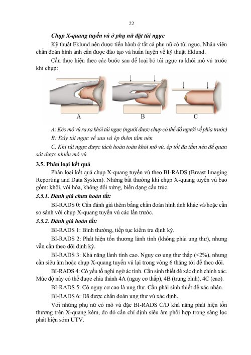 2HDSLUTV.signed-h&igrave;nh ảnh-21.jpg