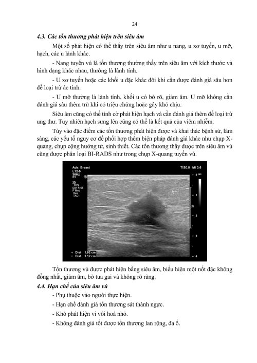 2HDSLUTV.signed-h&igrave;nh ảnh-23.jpg